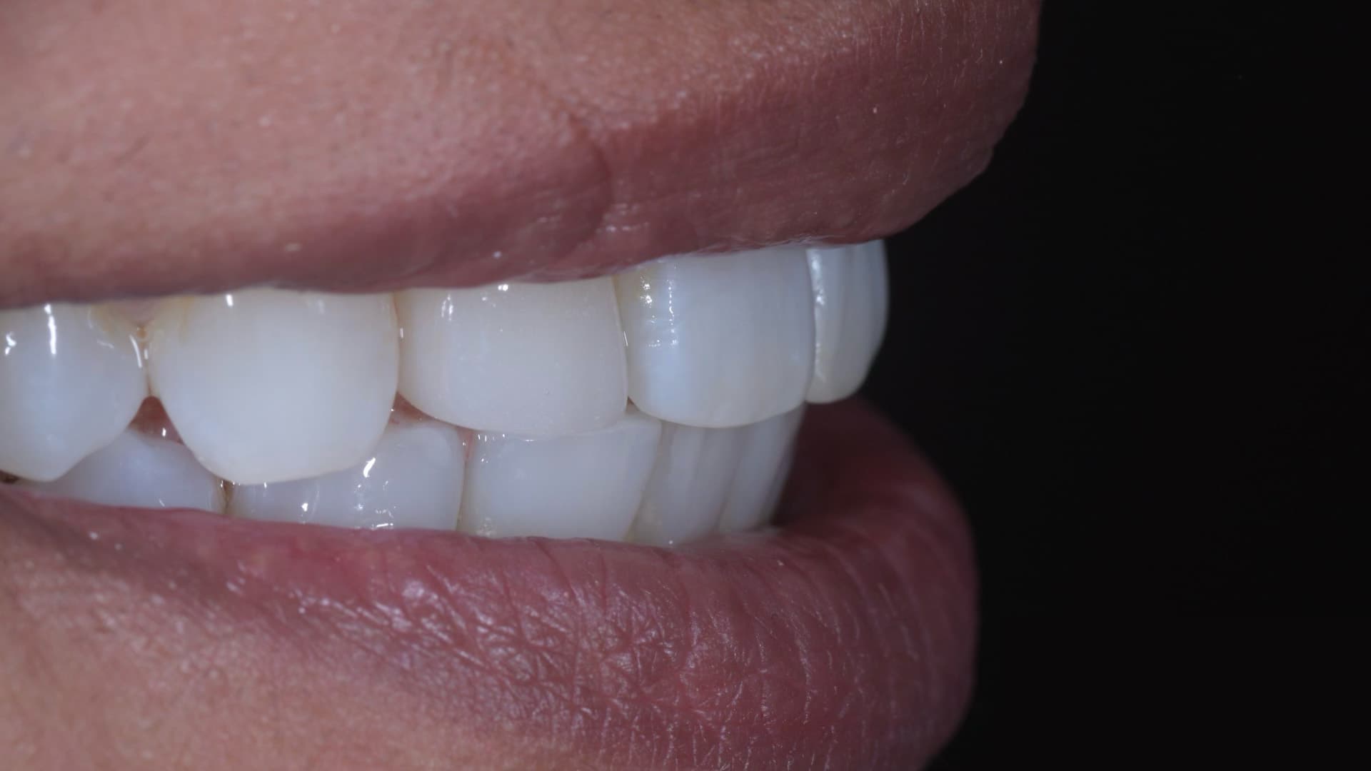 Cosmetic Dentistry Services